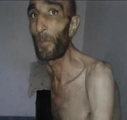 مشاهده علائم گاز سارين درسوريه