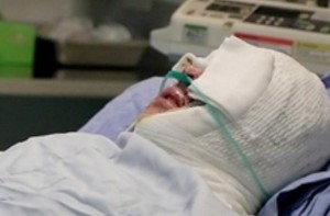 جنايت اسيدپاشي عليه دو دختر جوان در سمنان