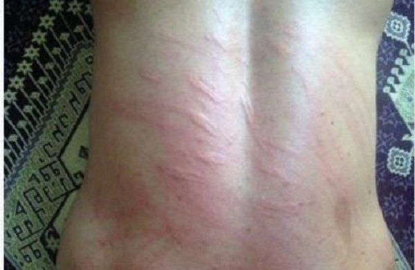 کولبر سیزدە ساله كرد زیر شکنجه کشته شد