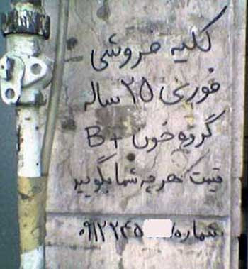 بازنگاهی به فاجعه تلخ فروش اعضای بدن در حاکمیت پلید آخوندی