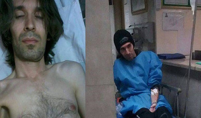 ابتلای آرش صادقی به تومور استخوانی بدخیم از سوی پزشک متخصص تأیید شد