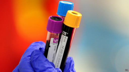 تشخیص افسردگی با آزمایش خون 'امکان‌پذیر' شد