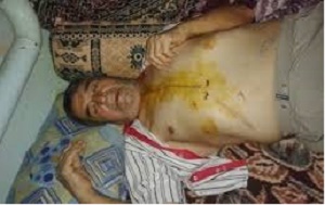 جان زنداني سياسي كرد به دليل عدم تكميل درمان در معرض خطر جدي است