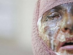 نوری زاد:با اطمینان می گویم تک تک نمایندگان مجلس اسیدپاشند. دستگاه قضائی اسیدپاش است. سپاه اسیدپاش است. بیت رهبری اسیدپاش است.