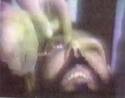 عفو بين‌الملل: قصاص چشم نهايت قساوت قوه قضاييه رژيم ايران را مي‌رساند