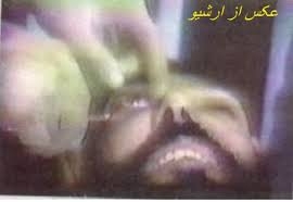 در يک عمل جنايتکارانه، رژيم ضدبشري آخوندي يک زنداني را از هر دو چشم نابينا کرد