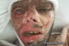 برلين: محكوميت اسيد پاشي در بوكان